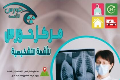 حورس للأشعة