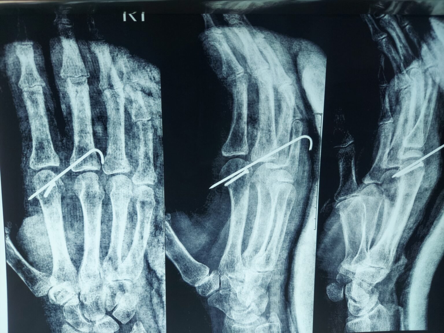 Dr Emil Roshdy Clinic عيادة د.اميل رشدى استشارى جراحة العظام
