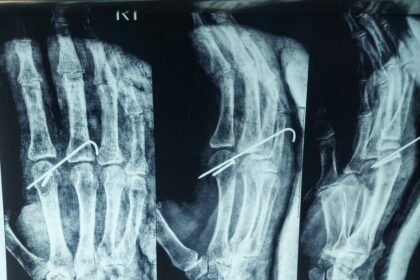 Dr Emil Roshdy Clinic عيادة د.اميل رشدى استشارى جراحة العظام